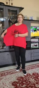 After Gastric Sleeve