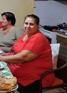 Before Gastric Sleeve